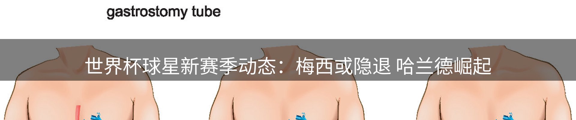 热点聚焦